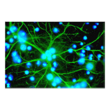 Astrocyte sind sternförmige Glial Zellen im Gehirn Fotografie