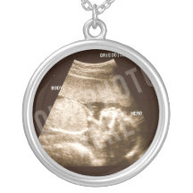 Baby-Ultraschall Keychain Selbst Gestalteter Schmuck