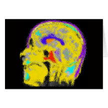 Das colorized MRI des Kennzeichens Grußkarte
