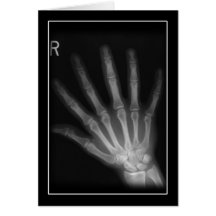 Extrastellen-Röntgenstrahl-rechte Hand Grußkarte