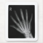 Extrastellen-Röntgenstrahl-rechte Hand Mauspads