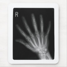 Extrastellen-Röntgenstrahl-rechte Hand Mauspads
