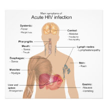 Hauptsymptome der akuten HIV-Infektion Fotodruck