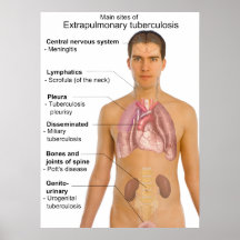 Hauptsymptome des Extrapulmonary Tuberkulose-Diagr Poster
