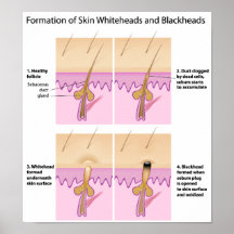 Haut Blackhead Plakat