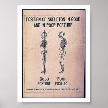 Position des Skeletts in in der guten und schlecht Plakatdruck