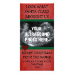 Unser Weihnachtsgeschenk-Ultraschall-Foto Bilderkarte