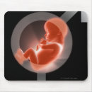 Suche nach erzeugt mousepads Schuss