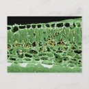 Suche nach chloroplast poster Mikrografie