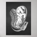 Suche nach schwangerschaft poster Für sie