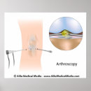 Suche nach orthopädisch poster Anatomie