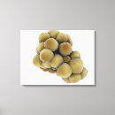 Suche nach tumor poster Krebszellen