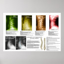 Suche nach spinal poster Anatomie