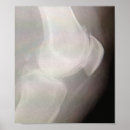 Suche nach knie poster Gelenk