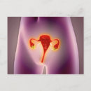 Suche nach uterus postkarten Innere organe