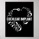 Suche nach implantate poster Cochlear