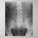 Suche nach orthopädie poster Arzt