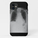 Suche nach ekg iphone hüllen Krankenhaus