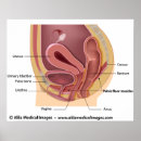 Suche nach pelvis poster Urologie