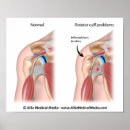 Suche nach gelenke poster Mensch