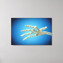 Suche nach gelenk leinwandbilder Medizin