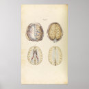 Suche nach gehirn poster Medizin