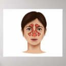 Suche nach sinus poster Medizin