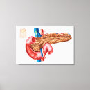 Suche nach aorta poster Detail