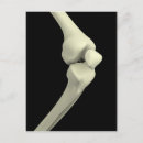 Suche nach knie postkarten Medizin