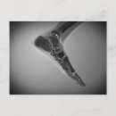 Suche nach menschlicher fuß postkarten Gesundheit