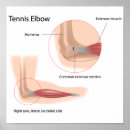 Suche nach tendon poster Anatomie