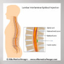 Suche nach orthopädisch poster Orthopädie