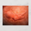 Suche nach embryo postkarten Schwanger