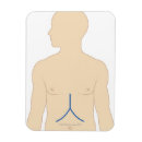 Suche nach transplantation magnete Medizinisch