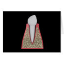 Suche nach molar postkarten Zahnfleisch