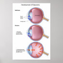 Suche nach retina poster Gesundheitswesen