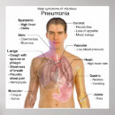 Suche nach pneumonie poster Bakterien