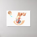 Suche nach drüse poster Grafik