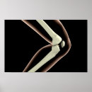 Suche nach knie poster Menschliches skelett