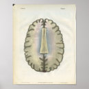 Suche nach brain poster Anatomy
