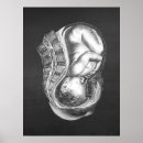 Suche nach obgyn poster Geburtshilfe
