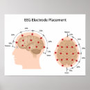 Suche nach epilepsie poster Brain