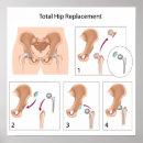 Suche nach orthopädisch poster Anatomie