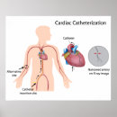 Suche nach kardiologie poster Operation