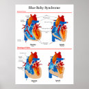 Suche nach diagram poster Chart