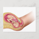 Suche nach weibliche anatomie postkarten Kein volk