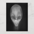 Suche nach röntgen postkarten Xray