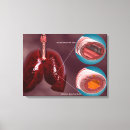 Suche nach virus leinwandbilder Medizin