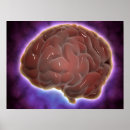 Suche nach neurologie poster 3d