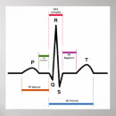 Suche nach ekg poster Diagramm